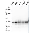 Western blot testing of human cell lysates with APE1 antibody (clone CPTC-APEX1-2). Predicted molecular weight ~38 kDa.