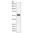 Western blot testing of human HeLa cell lysate with Myocyte enhancer factor 2A antibody. Predicted molecular weight: 46-55 kDa (multiple isoforms).