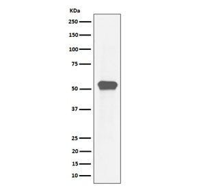 Western blot testing of human HeLa cell lysate with Myocyte enhancer factor 2A antibody. Predicted molecular weight: 46-55 kDa (multiple isoforms).