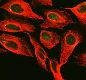 Immunofluorescent staining of PNKP using anti-PNKP antibody (green) and anti-Beta Tubulin antibody (red). PNKP was detected in an immunocytochemical section of U2OS cells. Enzyme antigen retrieval was performed using IHC enzyme antigen retrieval reagent for 15 mins. The cells were blocked with 10% goat serum. And then incubated with 5 ug/ml rabbit anti-PNKP antibody and mouse anti-Beta Tubulin antibody overnight at 4oC.