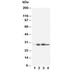 Western blot testing of Bcl-2 antibody and rat tissue: 1. heart; 2. spleen; 3. small intestine; 4: liver. Predicted molecular weight ~26 kDa.