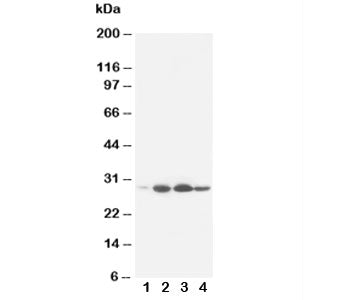Western blot testing of Bcl-2 antibody and rat tissue: 1. heart; 2. spleen; 3. small intestine; 4: liver. Predicted molecular weight ~26 kDa.
