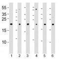 Western blot analysis of lysate from 1) 293T, 2) HeLa, 3) Jurkat, 4) Y79 cell line , 5) mouse spleen and 6) rat kidney tissue lysate using DHFR antibody at 1:1000. Predicted molecular weight ~22 kDa.