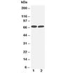 Western blot testing of TNFR2 antibody and Lane 1: MM453; 2: Jurkat cell lysate. Predicted molecular weight: 50 kDa (unmodified), 70-80 kDa (glycosylated).