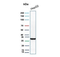 Western blot testing of human HepG2 cell lysate with Succinate dehydrogenase B antibody. Predicted molecular weight 25-32 kDa.