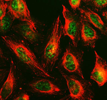 Immunofluorescent staining of TOX3 using anti-TOX3 antibody (green) and anti-Beta Tubulin antibody (red). TOX3 was detected in an immunocytochemical section of U2OS cells. Enzyme antigen retrieval was performed using IHC enzyme antigen retrieval reagent for 15 mins. The cells were blocked with 10% goat serum. And then incubated with 5 ug/ml rabbit anti-TOX3 antibody and mouse anti-Beta Tubulin antibody overnight at 4oC.