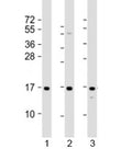 Western blot testing of human 1) A431, 2) HeLa and 3) U-2OS cell lysate with RPLP1 antibody at 1:2000. Predicted molecular weight: 12 kDa.