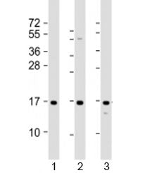 Western blot testing of human 1) A431, 2) HeLa and 3) U-2OS cell lysate with RPLP1 antibody at 1:2000. Predicted molecular weight: 12 kDa.