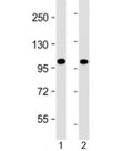 Western blot testing of human 1) Jurkat and 2) K562 cell lysate with PRDM16 antibody at 1:4000. Predicted molecular weight: 140 kDa.