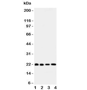 Western blot testing of Bid antibody and human samples 1: HeLa; 2: COLO320; 3: Jurkat; 4: SKOV lysate. Expected/observed molecular weight ~22 kDa.