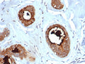 IHC staining of FFPE human lactating breast tissue with recombinant Mammaglobin A antibody (clone rMGB/6619). HIER: boil tissue sections in pH 9 10mM Tris with 1mM EDTA for 20 min and allow to cool before testing.