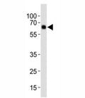 Western blot analysis of lysate from human placenta tissue, using Park6/ PINK1 antibody diluted at 1:1000. Predicted molecular weight: 60-70 kDa