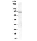 Western blot testing of human lung lysate with HPS6 antibody at 1ug/ml. Predicted molecular weight: ~83kDa, observed here at ~95kDa.