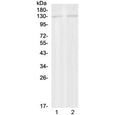 Western blot testing of 1) rat brain and 2) mouse brain with PSD antibody at 0.5ug/ml. Predicted molecular weight ~109 kDa.