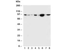 Western blot testing of b-Catenin antibody and Lane 1: rat brain; 2: rat heart; 3: rat testis; 4: human MCF-7; 5: (h) HeLa; 6: (h) M453; 7: (h) M231; 8: (h) HT1080 cell lysate. Predicted molecular weight ~85 kDa, but routinely observed at 90-95 kDa.