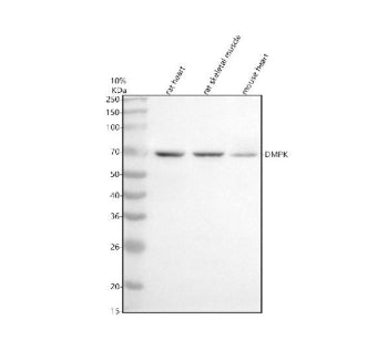 Western blot analysis of DMPK using anti-DMPK antibody. Electrophoresis was performed on a 10% SDS-PAGE gel at 80V (Stacking gel) / 120V (Resolving gel) for 2 hours. Lane 1: rat heart tissue lysates, Lane 2: rat skeletal muscle tissue lysates, Lane 3: mouse heart tissue lysates. After electrophoresis, proteins were transferred to a nitrocellulose membrane at 150 mA for 50-90 minutes. Blocked the membrane with 5% non-fat milk/TBS for 1.5 hour at RT. The membrane was incubated with rabbit anti-DMPK antibody a
