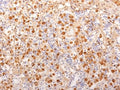 IHC testing of FFPE human pituitary gland with ACTH antibody