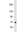 Western blot testing of human 293T/17 cell lysate with L3MBTL4 antibody at 1:2000. Predicted molecular weight: 71 kDa.
