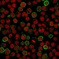 Immunofluorescence staining of human Raji cells with CD20 antibody (green, clone MS4A1/3411) and Reddot nuclear stain (red).
