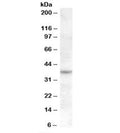 Western blot testing of Jurkat cell lysate with RASSF7 antibody at 1ug/ml. Predicted molecular weight: ~40kDa.