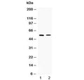 Western blot testing of 1) rat skeletal muscle and 2) human HepG2 lysate with CHRNA5 antibody at 0.5ug/ml. Predicted molecular weight ~53 kDa.