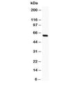 Western blot testing of SSTR1 antibody and rat intestine lysate; The protein is routinely visualized from 42~80 kDa due to glycosylation.