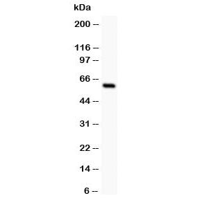 Western blot testing of SSTR1 antibody and rat intestine lysate; The protein is routinely visualized from 42~80 kDa due to glycosylation.