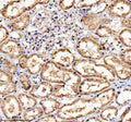 Immunohistochemical staining of TNFRSF10D using anti-TNFRSF10D antibody. TNFRSF10D was detected in a paraffin-embedded section of human kidney tissue. Heat mediated antigen retrieval was performed in EDTA buffer (pH 8.0, epitope retrieval solution). The tissue section was blocked with 10% goat serum. The tissue section was then incubated with 2 ug/ml rabbit anti-TNFRSF10D antibody overnight at 4oC. Peroxidase Conjugated Goat Anti-rabbit IgG was used as secondary antibody and incubated for 30 min at 37oC.