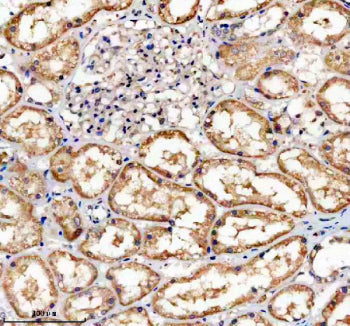 Immunohistochemical staining of TNFRSF10D using anti-TNFRSF10D antibody. TNFRSF10D was detected in a paraffin-embedded section of human kidney tissue. Heat mediated antigen retrieval was performed in EDTA buffer (pH 8.0, epitope retrieval solution). The tissue section was blocked with 10% goat serum. The tissue section was then incubated with 2 ug/ml rabbit anti-TNFRSF10D antibody overnight at 4oC. Peroxidase Conjugated Goat Anti-rabbit IgG was used as secondary antibody and incubated for 30 min at 37oC.