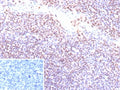 IHC staining of FFPE human tonsil tissue with recombinant EBV antibody (clone EBV/9620R). Inset: PBS used in place of primary Ab (secondary Ab negative control).