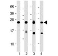 Western blot testing of 1) human heart, 2) human skeletal muscle, 3) mouse skeletal muscle and 4) rat skeletal muscle lysate with MYL1 antibody at 1:2000. Predicted molecular weight ~21 kDa.