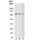 Western blot testing of A) Daudi, B) Jurkat and C) K562 lysates with OAS2 antibody at 0.3ug/ml. Predicted molecular weight: ~82/79kDa (isoforms 1/2), these isoforms can be observed at 71/69kDa.