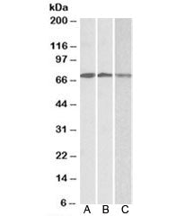 Western blot testing of A) Daudi, B) Jurkat and C) K562 lysates with OAS2 antibody at 0.3ug/ml. Predicted molecular weight: ~82/79kDa (isoforms 1/2), these isoforms can be observed at 71/69kDa.