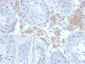 IHC staining of FFPE human ovary tissue with Growth Differentiation Factor 9 antibody (clone GDF9/6458). Inset: PBS used in place of primary Ab (secondary Ab negative control).