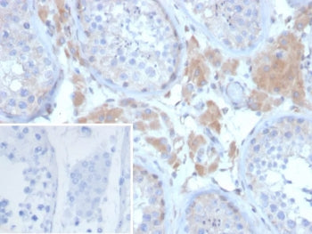IHC staining of FFPE human ovary tissue with Growth Differentiation Factor 9 antibody (clone GDF9/6458). Inset: PBS used in place of primary Ab (secondary Ab negative control).