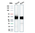 Western blot testing of human tonsil and brain tissue lysate with recombinant PDCD1 antibody. Predicted molecular weight: 32-55 kDa depending on glycosylation level.