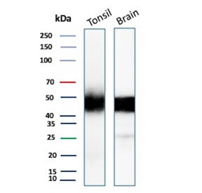 Western blot testing of human tonsil and brain tissue lysate with recombinant PDCD1 antibody. Predicted molecular weight: 32-55 kDa depending on glycosylation level.
