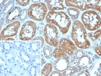 IHC staining of FFPE human kidney tissue with Deleted in breast cancer 2 antibody (clone DBC2/4570). Inset: PBS used in place of primary Ab (secondary Ab negative control). HIER: boil tissue sections in pH 9 10mM Tris with 1mM EDTA for 20 min and allow to cool before testing.