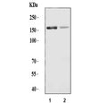 Western blot testing of 1) rat liver and 2) mouse liver tissue lysate with ADAMTS13 antibody. Predicted molecular weight ~154 kDa.