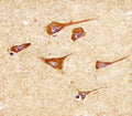 IHC testing of FFPE human brain tissue with Superoxide Dismutase 2 antibody. HIER: steam section in pH6 citrate buffer for 20 min and allow to cool prior to staining.