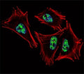 Fluorescent confocal image of A2058 cell stained with PROX1 antibody at 1:25. PROX1 immunoreactivity is localized to the nucleus.