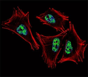 Fluorescent confocal image of A2058 cell stained with PROX1 antibody at 1:25. PROX1 immunoreactivity is localized to the nucleus.