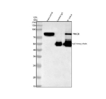 Western blot testing of PKC beta antibody and lysate from 1: rat brain; 2: mouse brain; 3: human COLO320 cells. Predicted molecular weight ~76 kDa.