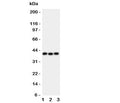 Western blot testing of WNT5A antibody and Lane 1: HeLa; 2: MCF-7; 3: HT1080 lysate. Predicted molecular weight ~41 kDa, commonly observed at 41-45 kDa.