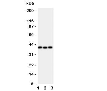 Western blot testing of WNT5A antibody and Lane 1: HeLa; 2: MCF-7; 3: HT1080 lysate. Predicted molecular weight ~41 kDa, commonly observed at 41-45 kDa.