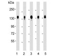 Western blot testing of human 1) HeLa, 2) MDA-MB-231, 3) HepG2, 4) SW480 and 5) A549 cell lysate with CD130 antibody. Expected molecular weight: 104-140 kDa depending on glycosylation level.
