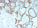 IHC staining of FFPE human placental tissue with Epstein-Barr virus induced 3 antibody (clone EBI3/8904). Inset: PBS used in place of primary Ab (secondary Ab negative control). HIER: boil tissue sections in pH 9 10mM Tris with 1mM EDTA for 20 min and allow to cool before testing.