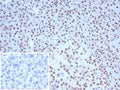 IHC staining of FFPE human pancreatic tissue with Nucleolin antibody (clone NCL/7338). HIER: boil tissue sections in pH 9 10mM Tris with 1mM EDTA for 20 min and allow to cool before testing.