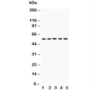 Western blot testing of GLUT4 antibody and Lane 1: rat heart; 2: rat skeletal muscle; 3: mouse heart; 4: mouse skeletal muscle; 5: human HeLa lysate. Predicted molecular weight: 45-55kDa.