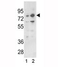 Western blot analysis of PLZF antibody and 1) 293 and 2) K562 lysate. Predicted molecular weight: 74-81 kDa.